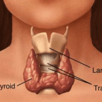 Suffering from thyroid fatigue or hypothyroidism symptoms?