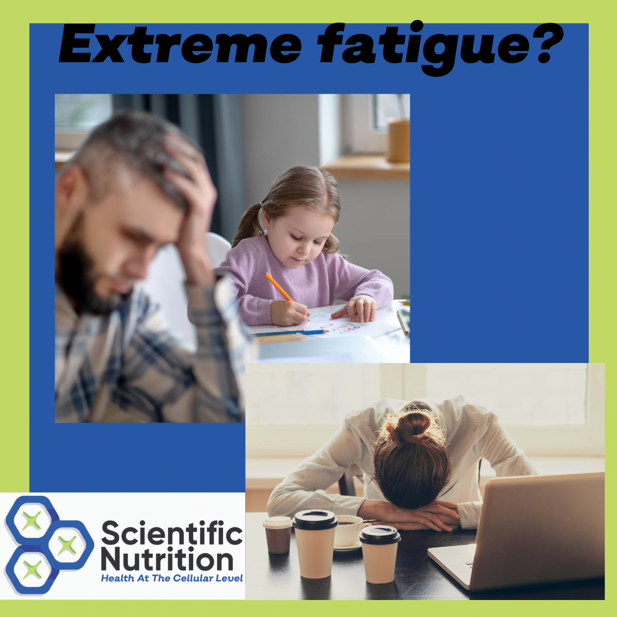 could-you-have-adrenal-burnout-resulting-in-extreme-fatigue-hair