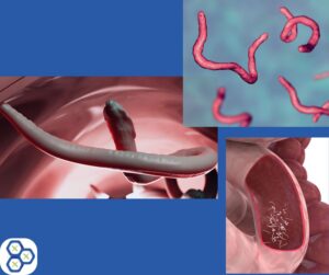Read more about the article Human Parasites Which Can I Get? Types, Symptoms & Solutions