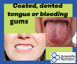 Your mouth can be telling you that you have gallstone, liver, and digestive issues.