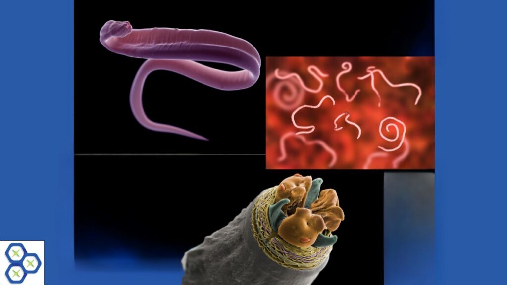 Microscopic and clinical imagery of intestinal roundworms showing full-body parasite structure, a cluster of nematodes against a tissue background, and a close-up scanning electron micrograph of a roundworm oral capsule.