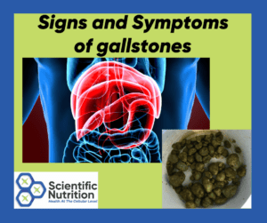 Read more about the article Signs and symptoms of gallstones causing health issues
