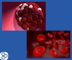 Read more about the article How to Prevent Blood Clots Naturally?