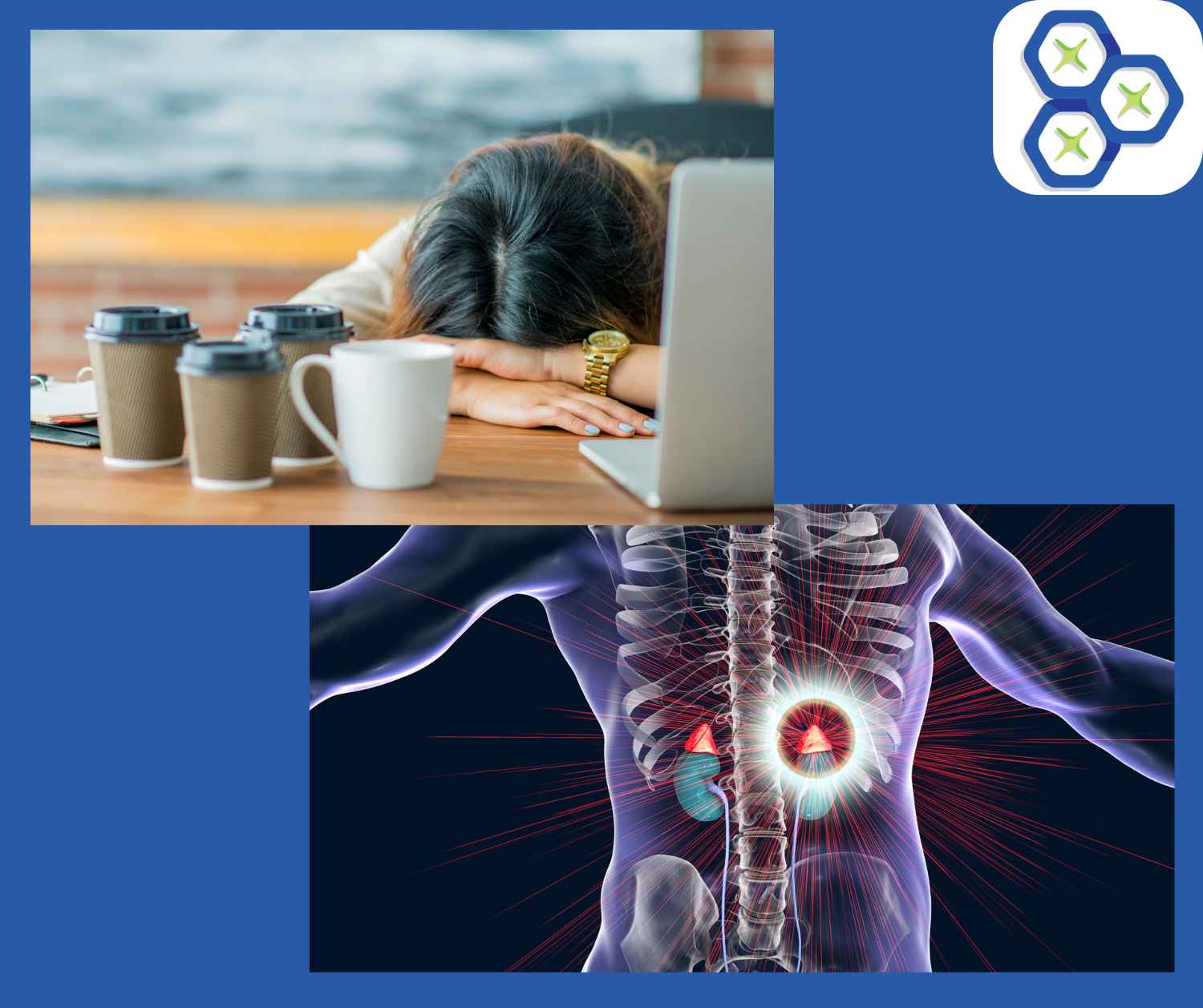 You are currently viewing Managing Adrenal Burnout with Hair Analysis 