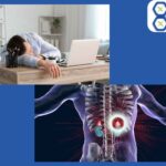 Is Adrenal Fatigue real? 3 natural solutions to prevent it