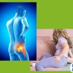 Sciatic Nerve Pain Relief Naturally with These Essential Vitamins