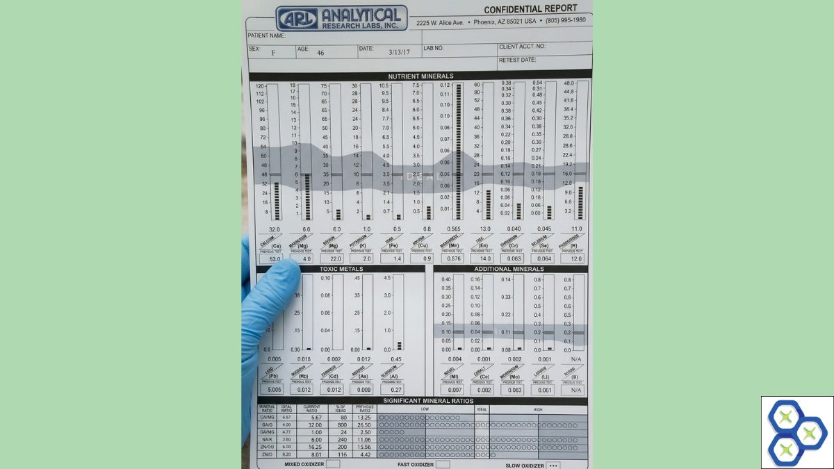 Standard ARL hair tissue mineral analysis report with significant metabolic ratios and metabolic typing.